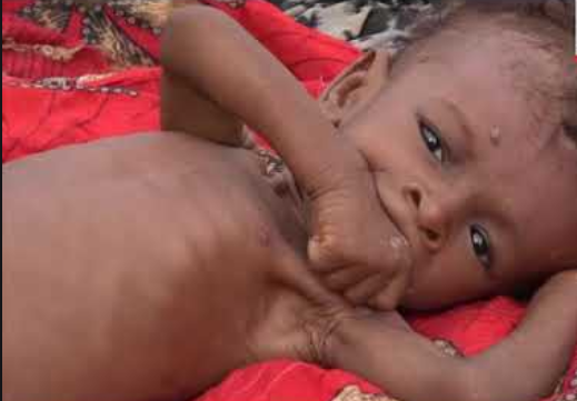 United Nations warned that next year, “more than half of all Yemenis will go hungry,” with “five million people to be living jus