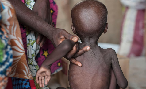 2.3 million children and youth, including some 700,000 children under five, are going hungry in North-East Nigeria."