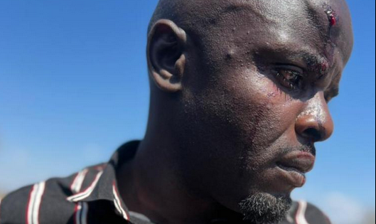 Zimbabwean authorities should investigate the brutal assault of four journalists